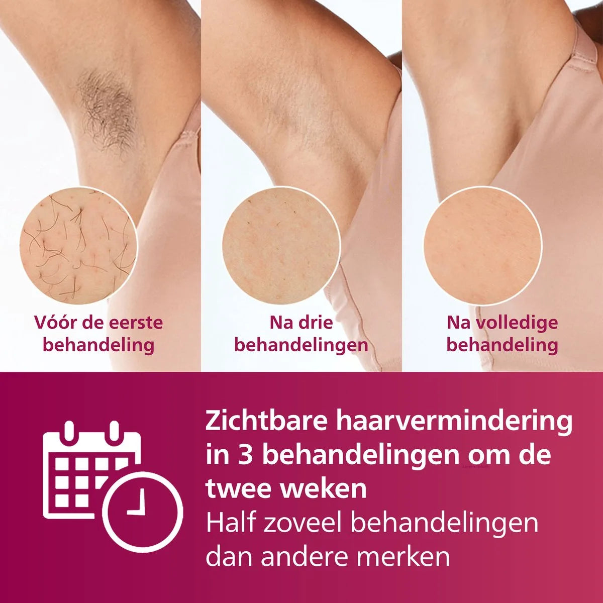 Philips Lumea IPL 7000 series - IPL Ontharingsapparaat - 3 opzetstukken met trimmer - BRI923/00